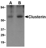 Anti Human Clusterin Antibody gallery image 1