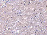 Anti Human Clusterin Antibody gallery image 2