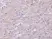 Anti Human Clusterin Antibody thumbnail image 2