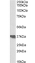 Anti Human Clusterin (C-Terminal) Antibody thumbnail image 1