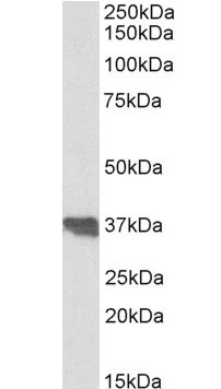Anti Human Clusterin (C-Terminal) Antibody gallery image 1