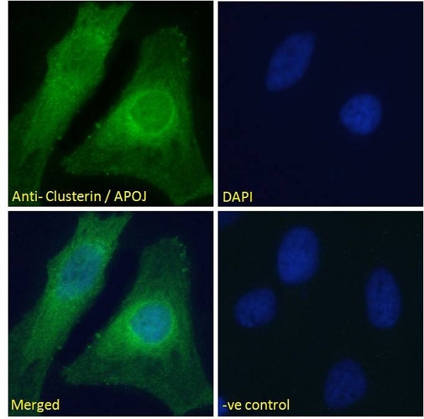 Anti Human Clusterin (C-Terminal) Antibody gallery image 2