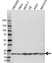 Anti Cofilin 1 Antibody (PrecisionAb Polyclonal Antibody) thumbnail image 1
