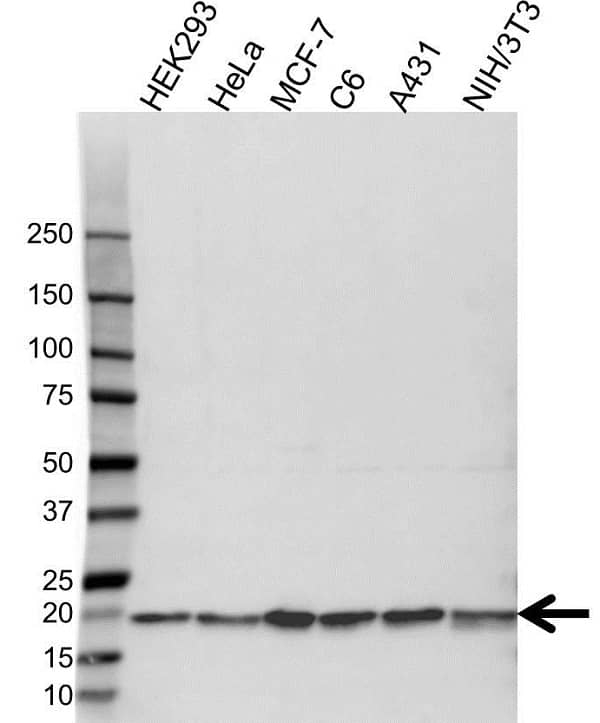 Anti Cofilin 1 Antibody (PrecisionAb Polyclonal Antibody) gallery image 1