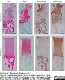 Anti Human Collagen I Antibody gallery image 1