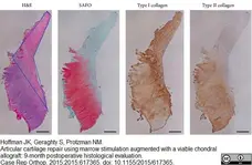 Anti Human Collagen I Antibody gallery image 2