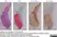 Anti Human Collagen I Antibody thumbnail image 2