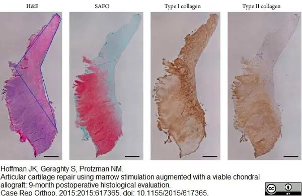 Anti Human Collagen I Antibody gallery image 2