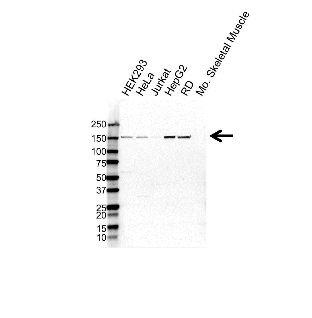 Anti Collagen IV Alpha 5 Antibody (PrecisionAb Polyclonal Antibody) gallery image 1