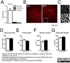 Goat Anti Human Collagen IV Antibody  gallery image 1