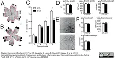 Goat Anti Human Collagen IV Antibody  gallery image 2