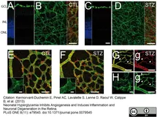 Goat Anti Human Collagen IV Antibody  gallery image 3