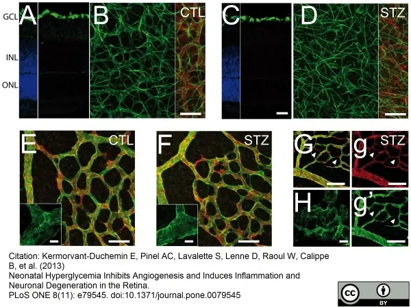 Goat Anti Human Collagen IV Antibody  gallery image 3
