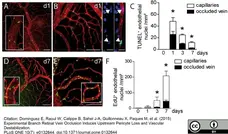 Goat Anti Human Collagen IV Antibody  gallery image 4