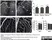Goat Anti Human Collagen IV Antibody  thumbnail image 5