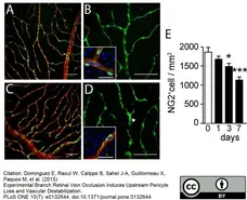 Goat Anti Human Collagen IV Antibody  gallery image 6