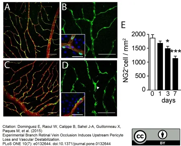 Goat Anti Human Collagen IV Antibody  gallery image 6