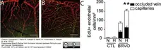 Goat Anti Human Collagen IV Antibody  gallery image 7