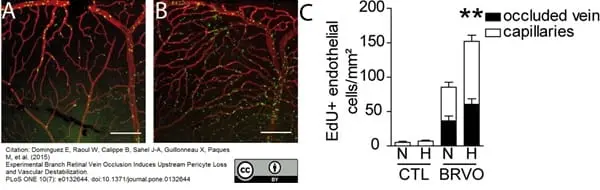 Goat Anti Human Collagen IV Antibody  gallery image 7