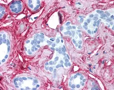 Anti Collagen VI Antibody gallery image 1