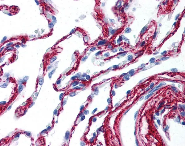Anti Collagen VI Antibody gallery image 2