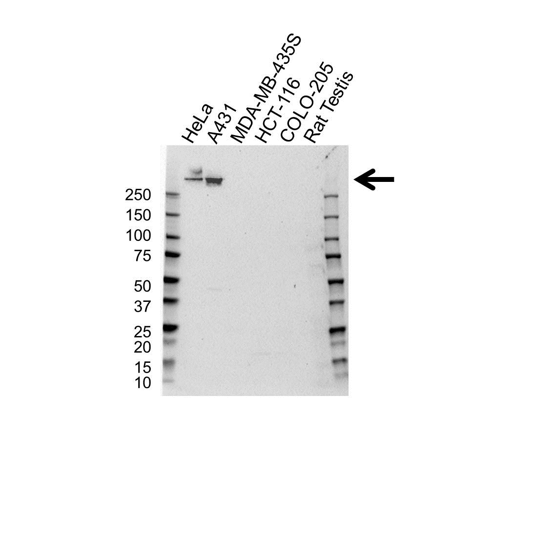 Anti Collagen VII Antibody (PrecisionAb Polyclonal Antibody) gallery image 1