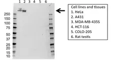 Anti Collagen VII Antibody (PrecisionAb Polyclonal Antibody) gallery image 1