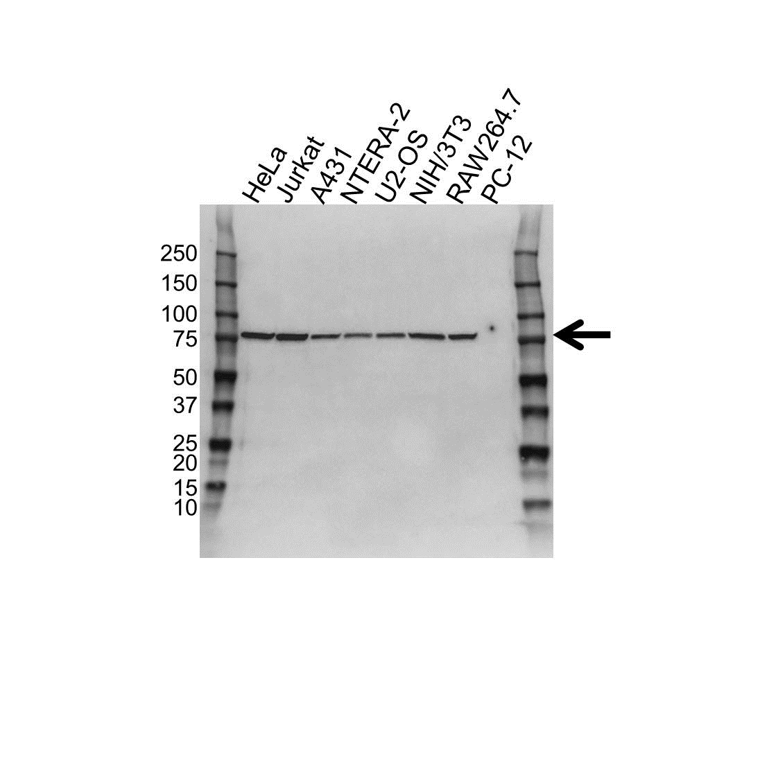 Anti CPSF3 Antibody (PrecisionAb Polyclonal Antibody) gallery image 1