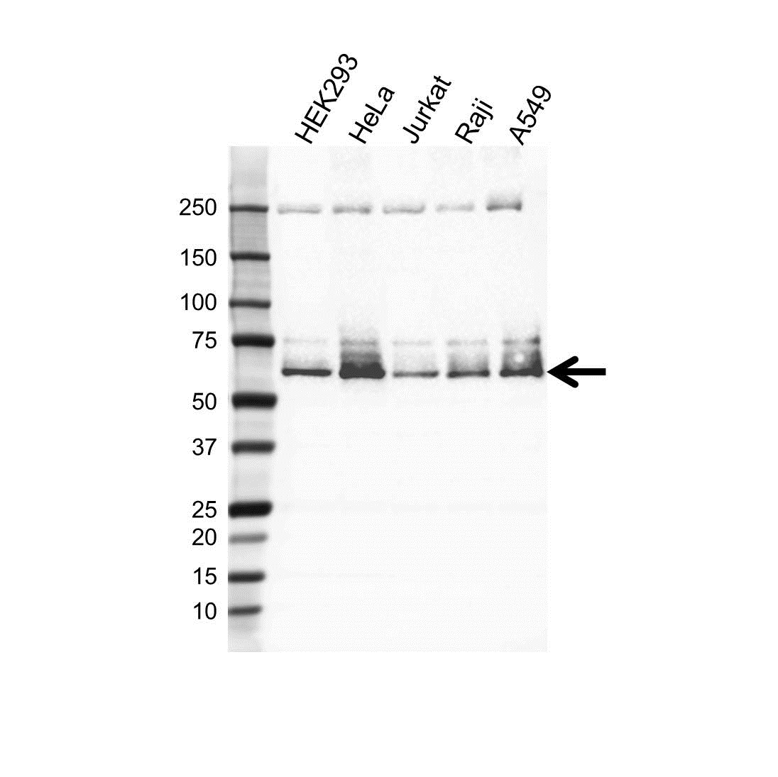 Anti CREB3L2 Antibody (PrecisionAb Polyclonal Antibody) gallery image 1
