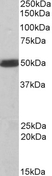 Anti Human CSK (C-Terminal) Antibody thumbnail image 3