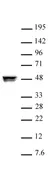 Anti Human CtBP2 Antibody thumbnail image 1