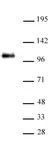Anti Human CTCF Antibody thumbnail image 1