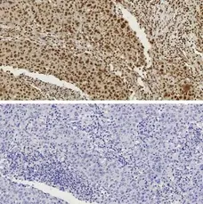Anti Human CTCF Antibody gallery image 2