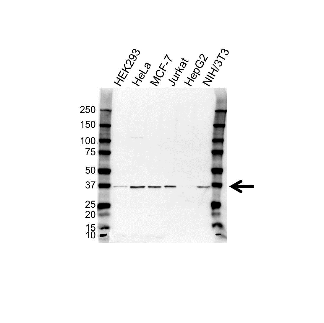 Anti Ctdspl Antibody (PrecisionAb Polyclonal Antibody) gallery image 1