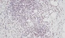 Anti Human CTGF Antibody gallery image 1