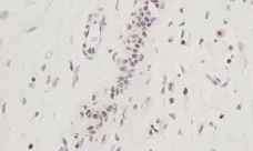 Anti Human CTGF Antibody gallery image 2