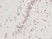 Anti Human CTGF Antibody thumbnail image 1