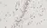 Anti Human CTGF Antibody thumbnail image 2