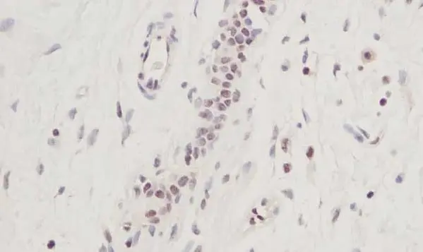 Anti Human CTGF Antibody gallery image 2