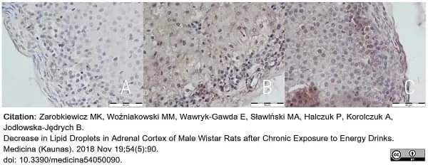 Anti Human CTGF Antibody gallery image 3