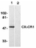 Anti Human CX3CR1 (N-Terminal) Antibody thumbnail image 1