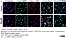 Anti Human CX3CR1 (N-Terminal) Antibody gallery image 2