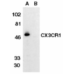 Anti Human CX3CR1 Antibody gallery image 1