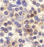Anti Human CX3CR1 Antibody gallery image 2