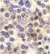 Anti Human CX3CR1 Antibody gallery image 2