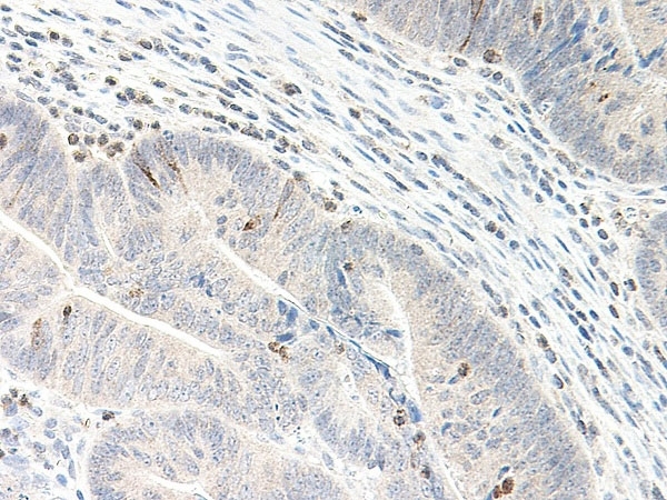 Anti Human CXCL5 Antibody thumbnail image 1