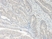 Anti Human CXCL5 Antibody thumbnail image 2