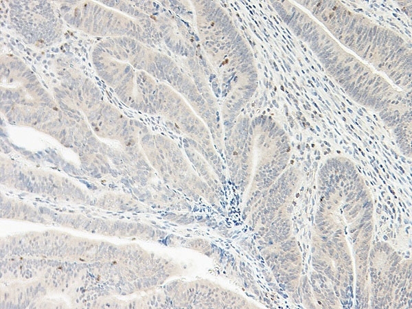 Anti Human CXCL5 Antibody thumbnail image 2