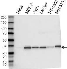 Anti Cyclin D1 Antibody (PrecisionAb Polyclonal Antibody) gallery image 1