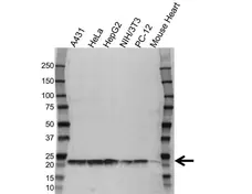 Anti Cyclophilin B Antibody (PrecisionAb Polyclonal Antibody) gallery image 1
